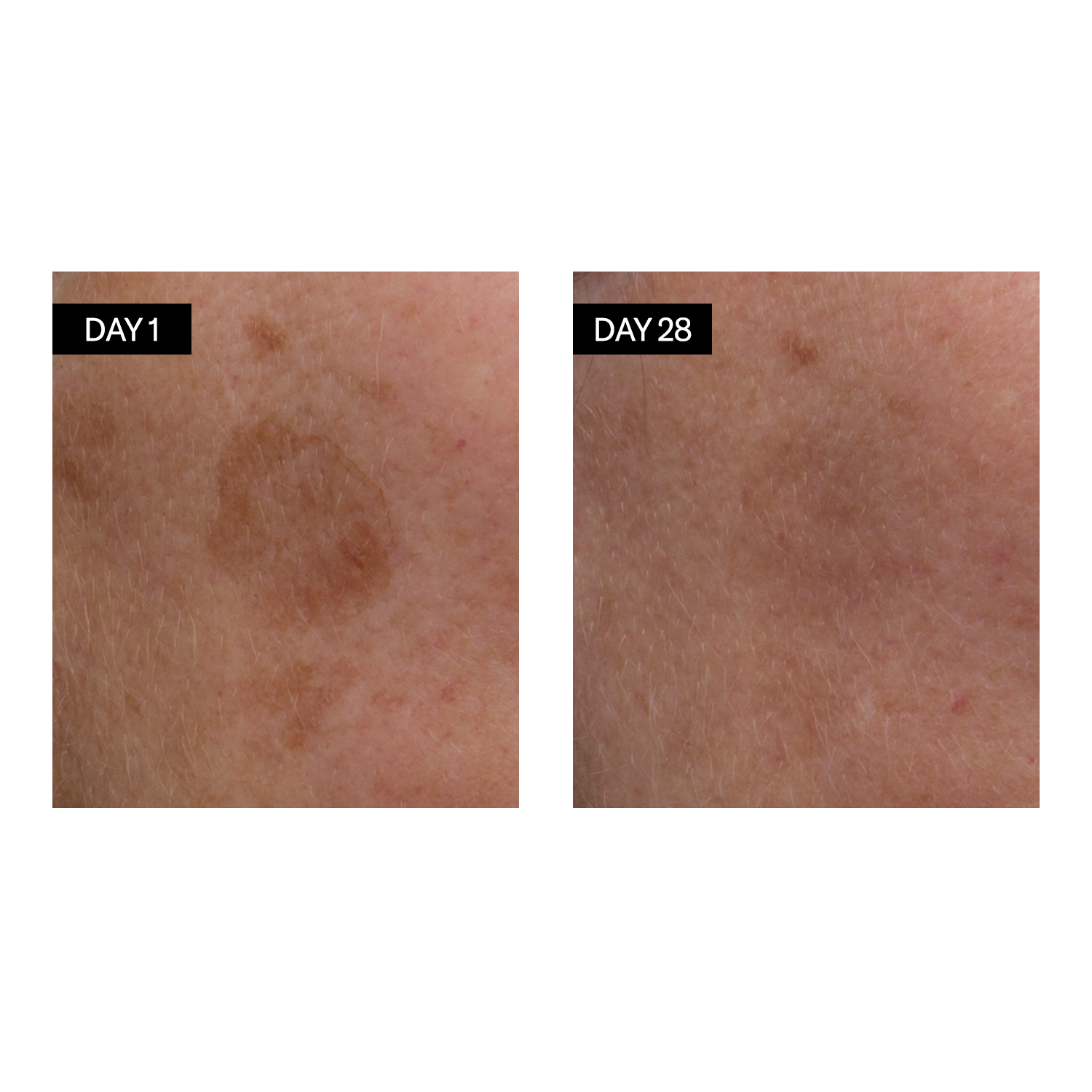 Sérum Visage Éclat à la Vitamine C & E et à l’Acide Hyaluronique Odacité