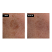 Sérum Visage Éclat à la Vitamine C & E et à l’Acide Hyaluronique Odacité