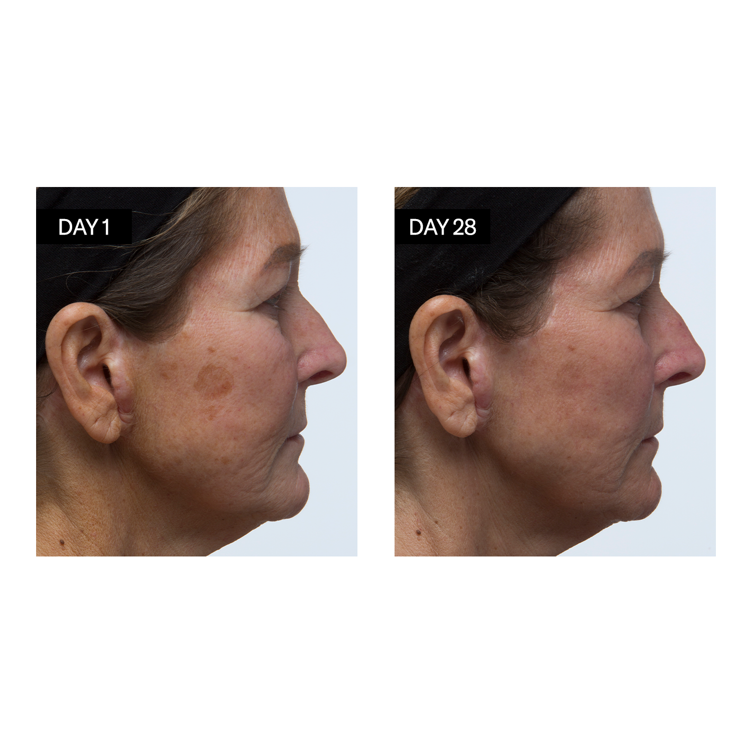 Sérum Visage Éclat à la Vitamine C & E et à l’Acide Hyaluronique Odacité