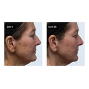 Sérum Visage Éclat à la Vitamine C & E et à l’Acide Hyaluronique Odacité