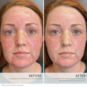 Sérum Correcteur de Teint HydroPure Jane Iredale