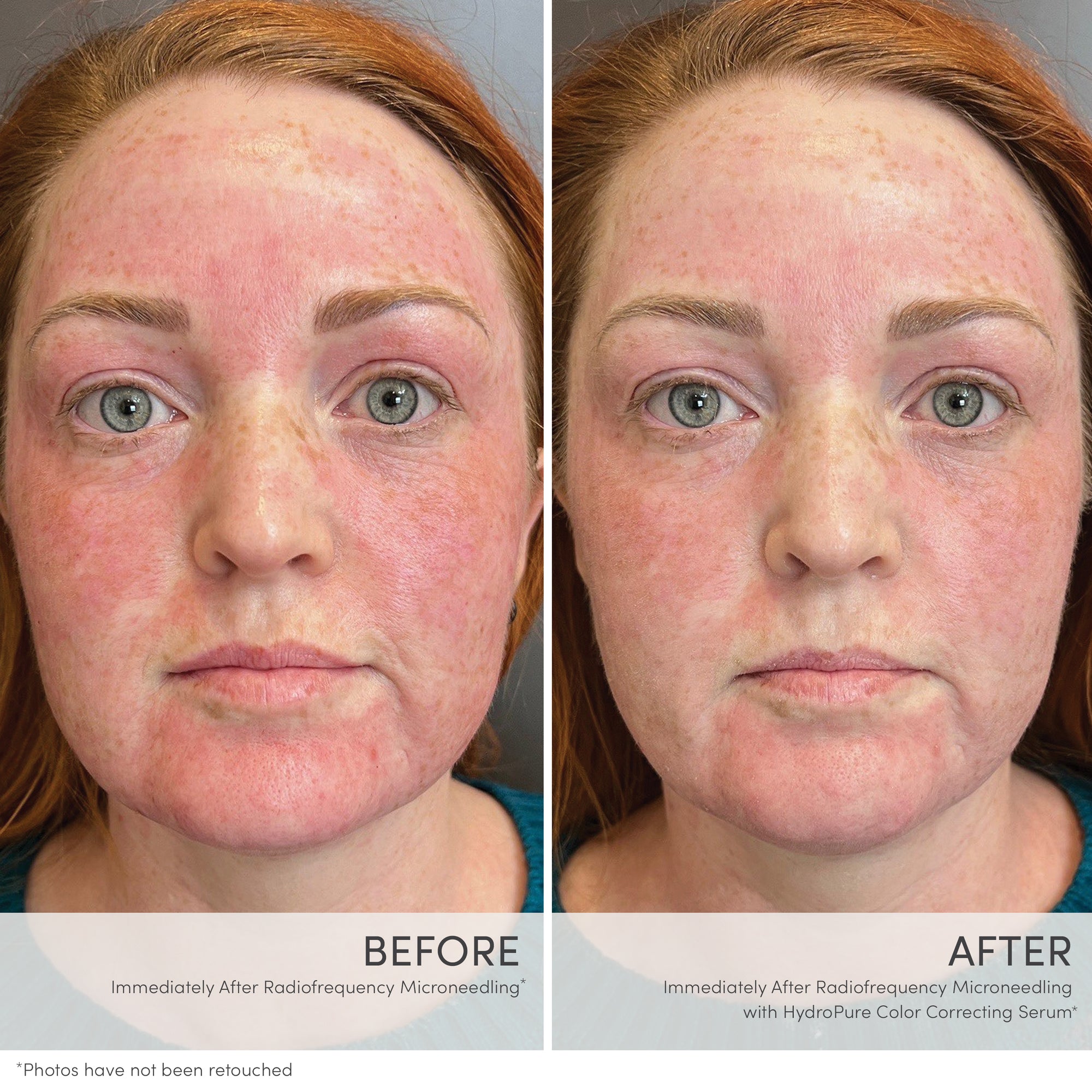Sérum Correcteur de Teint HydroPure Jane Iredale